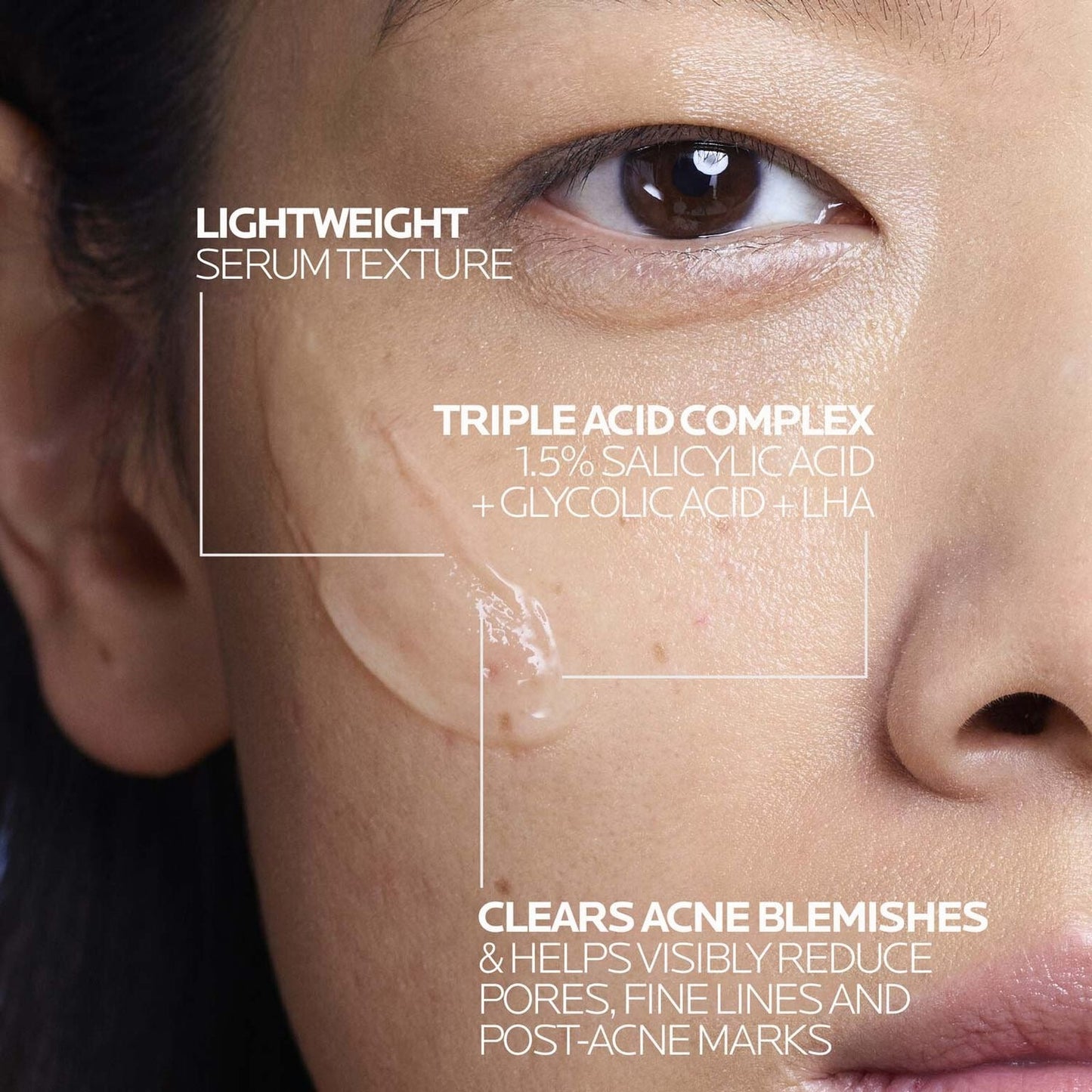 La Roche-Posay Effaclar 1.5% Salicylic Acid Serum, Acne Treatment For Face With Glycolic Acid & Niacinamide, Acne Serum Helps Clear Blackheads, Whiteheads, Pimples & Reduces Post Acne Marks